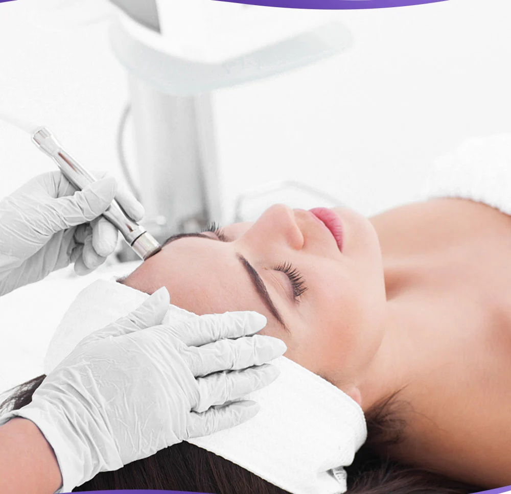 diamond microdermabrasion